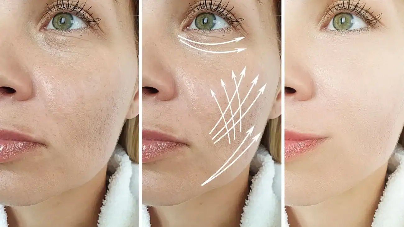 Can One Treatment Really Tackle More Than One Skin Concern Bedworth?