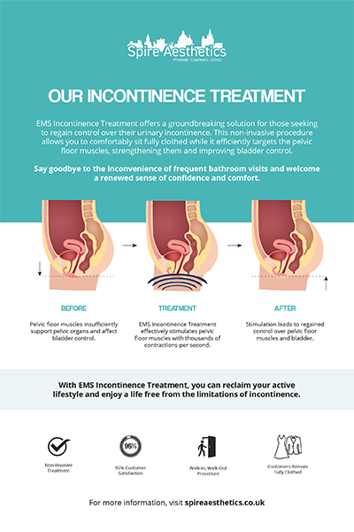 image to show how EMS treatment works for female urinary incontinence Bedworth