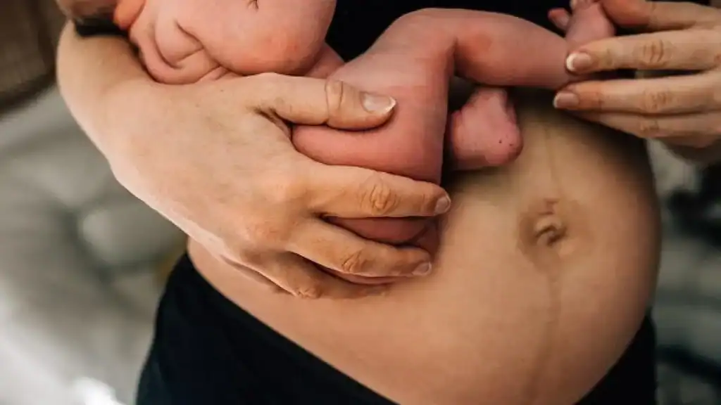 Why Is My Stomach Still Big After Pregnancy Bedworth?